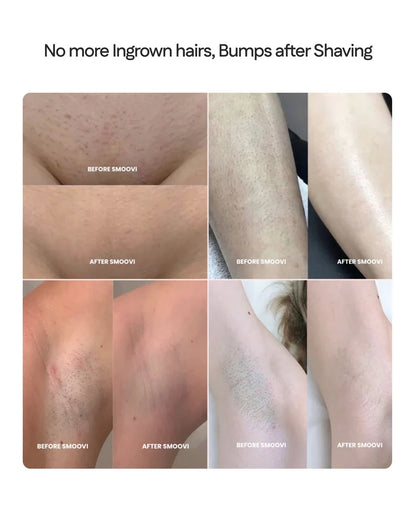 Bikini Dual Head Shaver Pro™